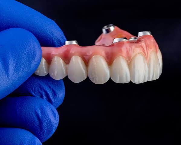 Resultado de Prótese Dentária